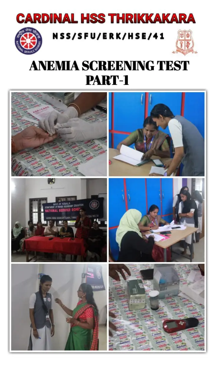 nss (13)